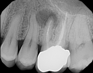 Operating Cyst-em